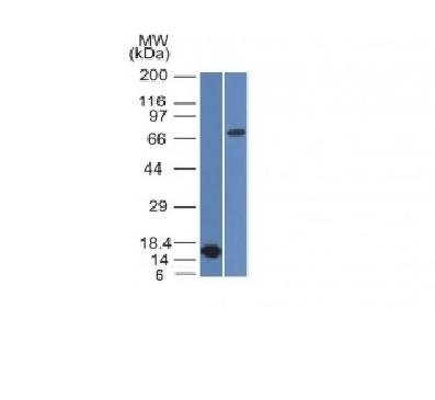 WB - Anti-Bcl-6 Antibody AH13482-20